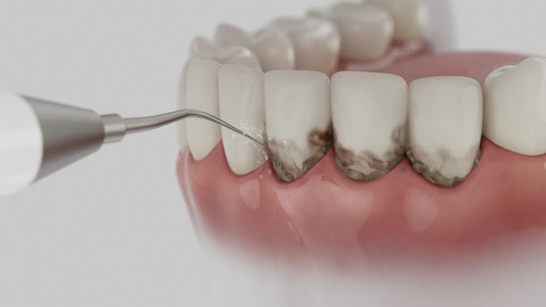Reliable Wisdom Tooth Removal contractor in Montgomery County County, MD by Dentist Open Now
